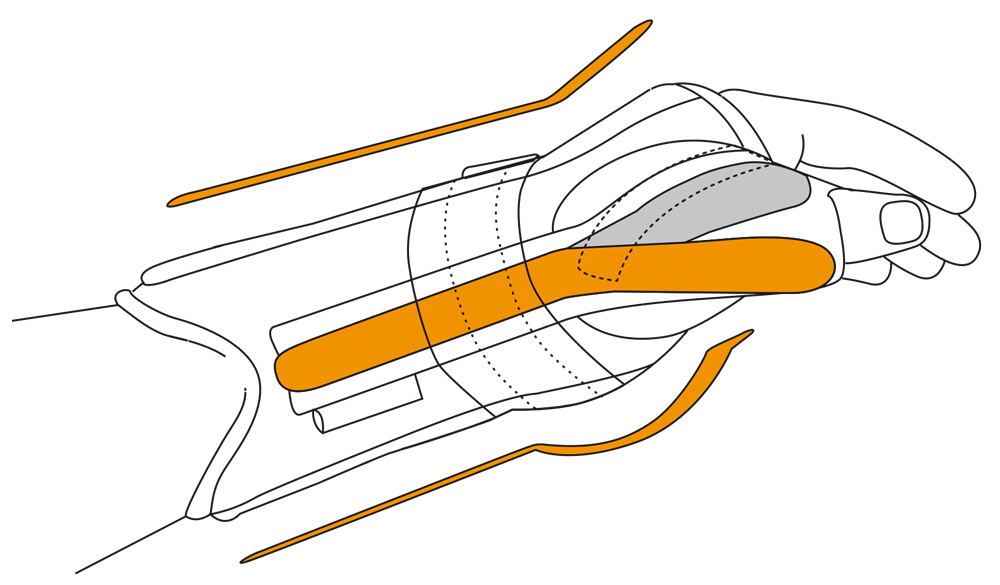 ORTHESE D'IMMOBILISATION POIGNET MAIN TENDINITE ARTHROSE SALVA